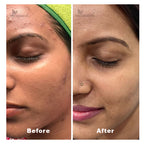 Bhramarah Face Pack Powder For Brightening