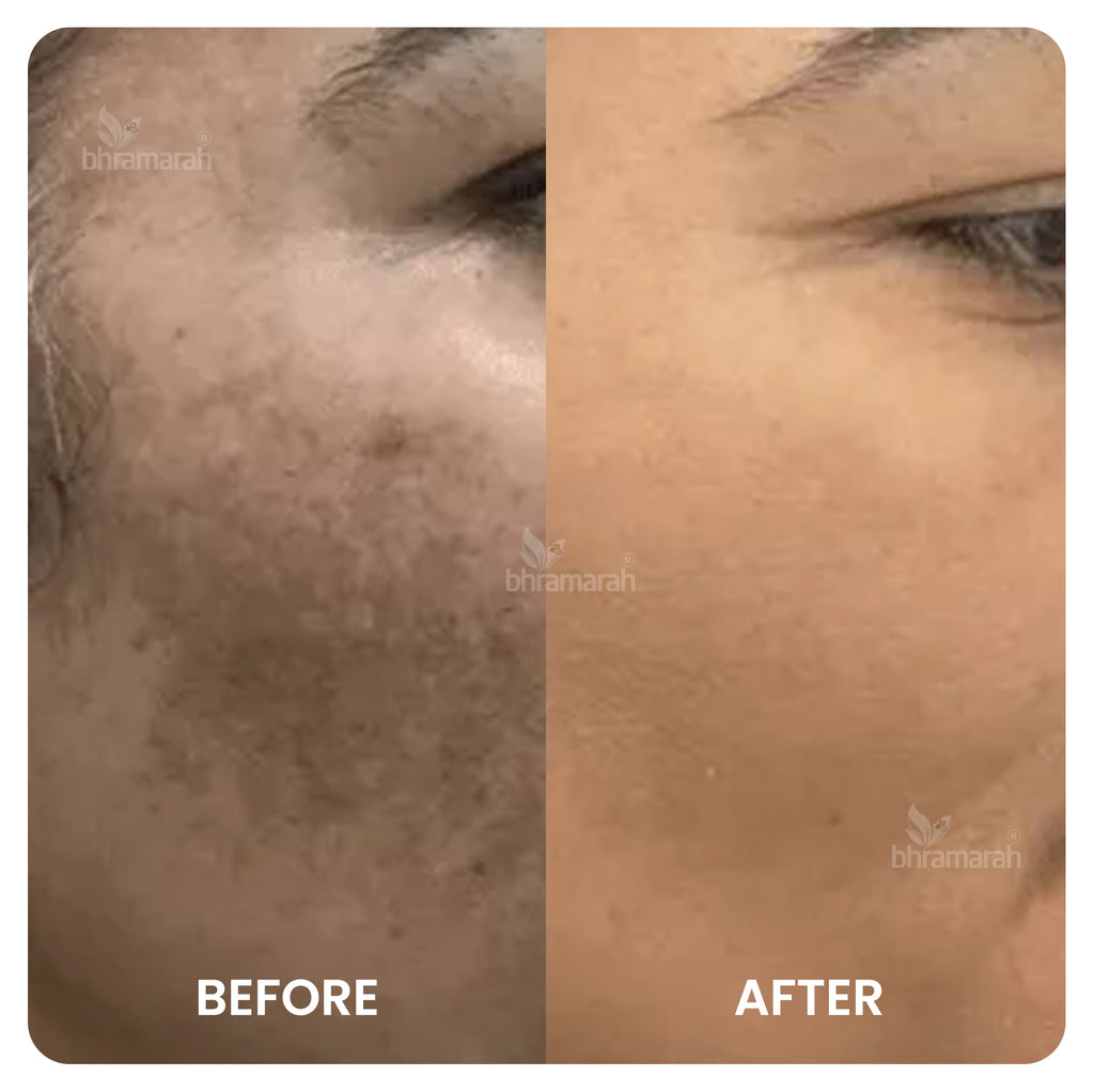 Brightening Face Cream