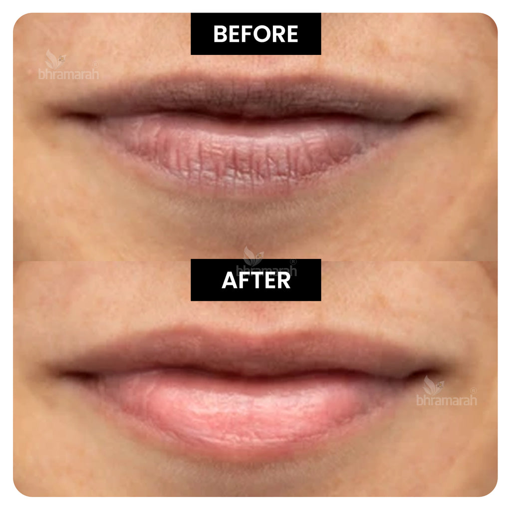 Shea Butter Lip Balm (Organic)