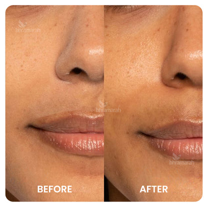 Face cream (Dry Skin)