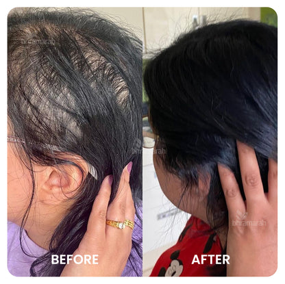 Premium Hair Growth oil