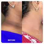 Neck and Underarm Brightening Cream