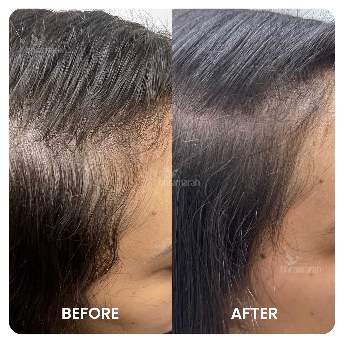 Aja ksheera Hair Oil