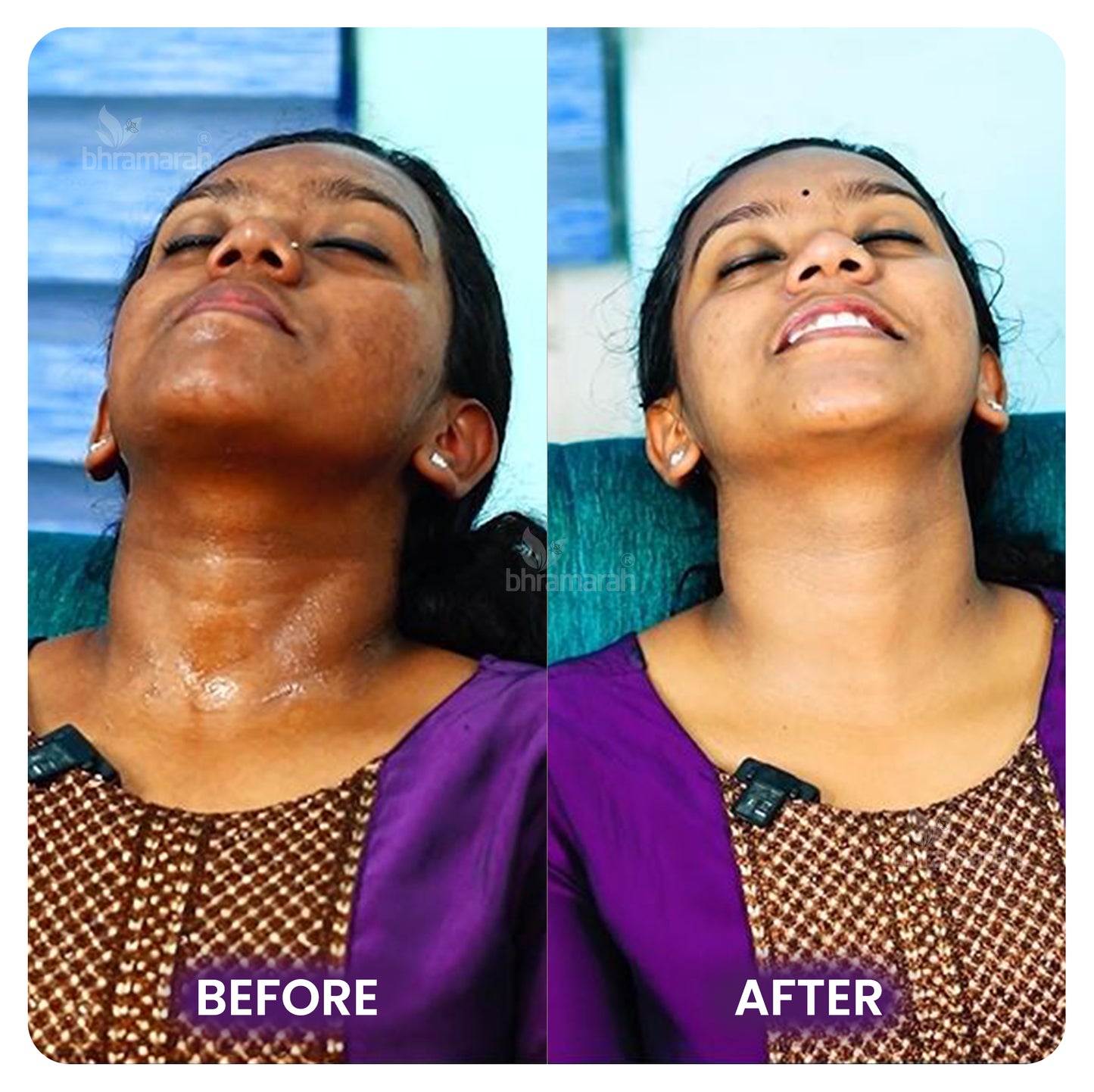 Brightening Facial Kit