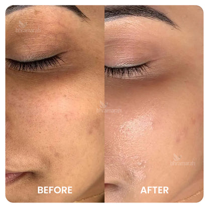 Golden Glow Facial Mask