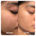 Face Cream (Normal to Oily)