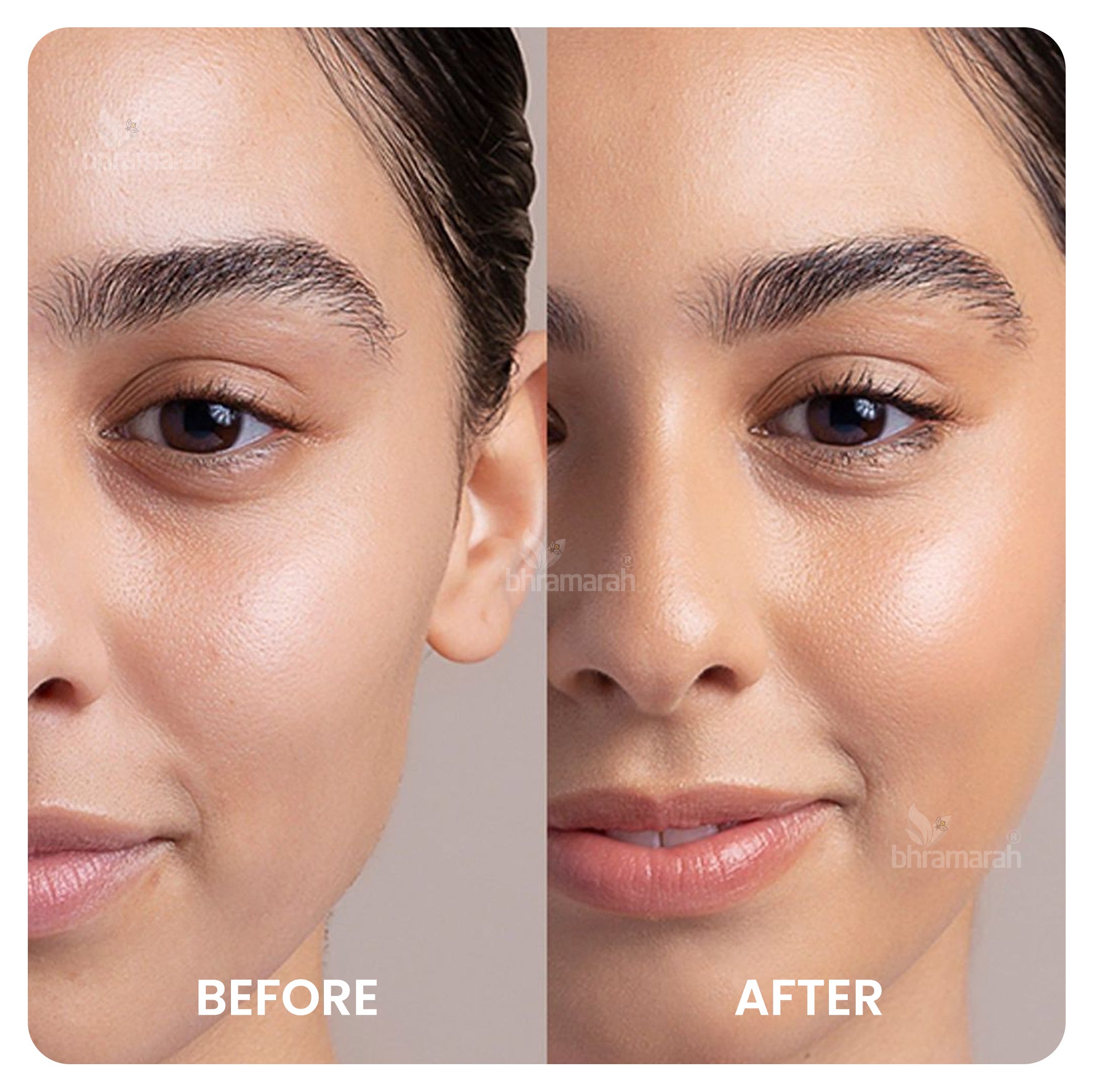 Sun screen SPF - 30 UVA|UVB