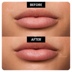 Lip Serum
