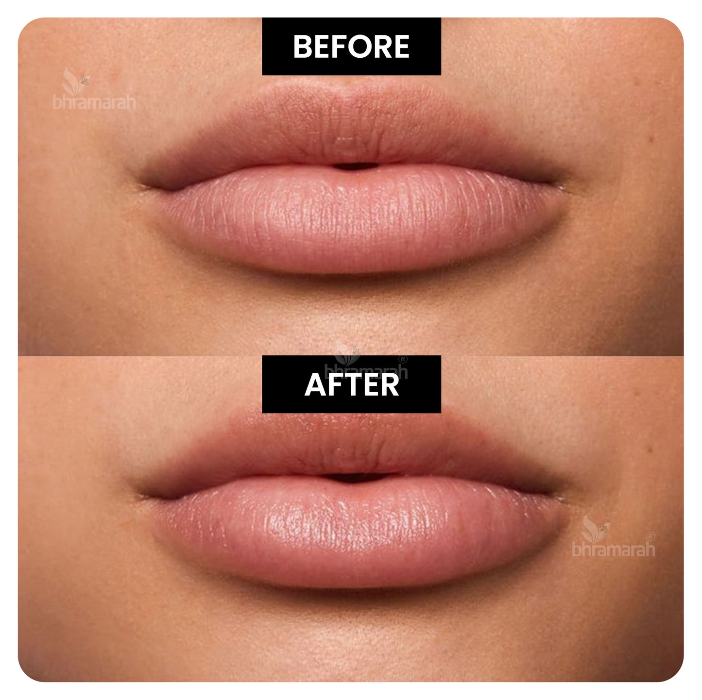 Lip Serum