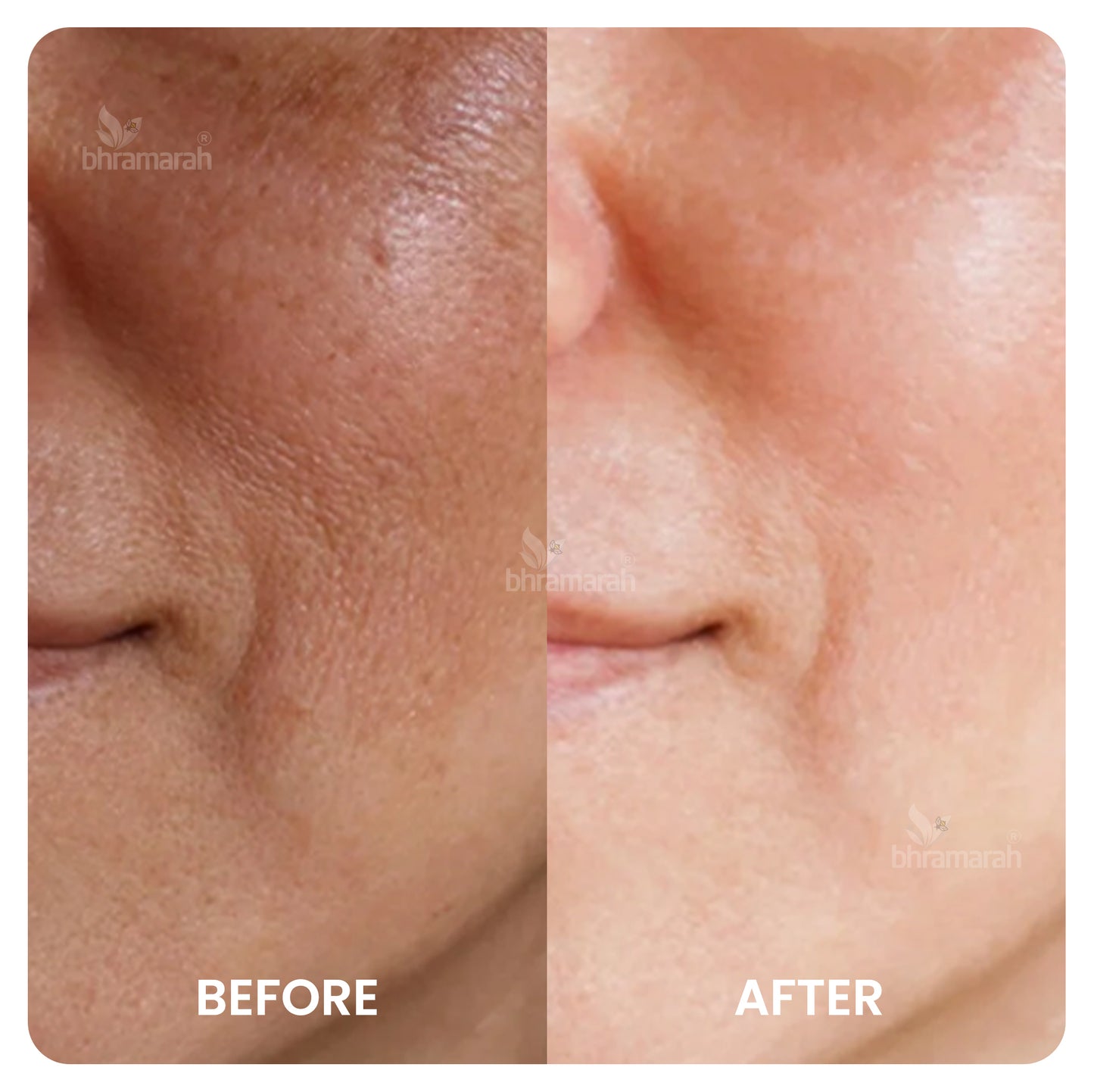 1 Minute Facial for Brightening