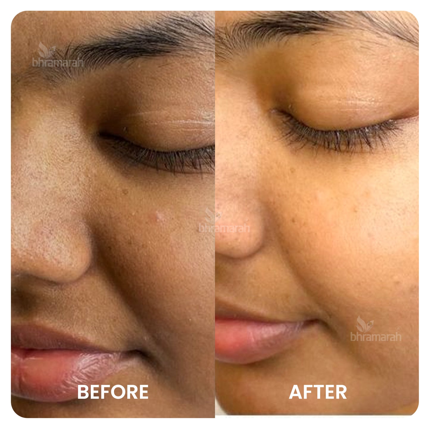 De Tan - Skin Brightening Combo