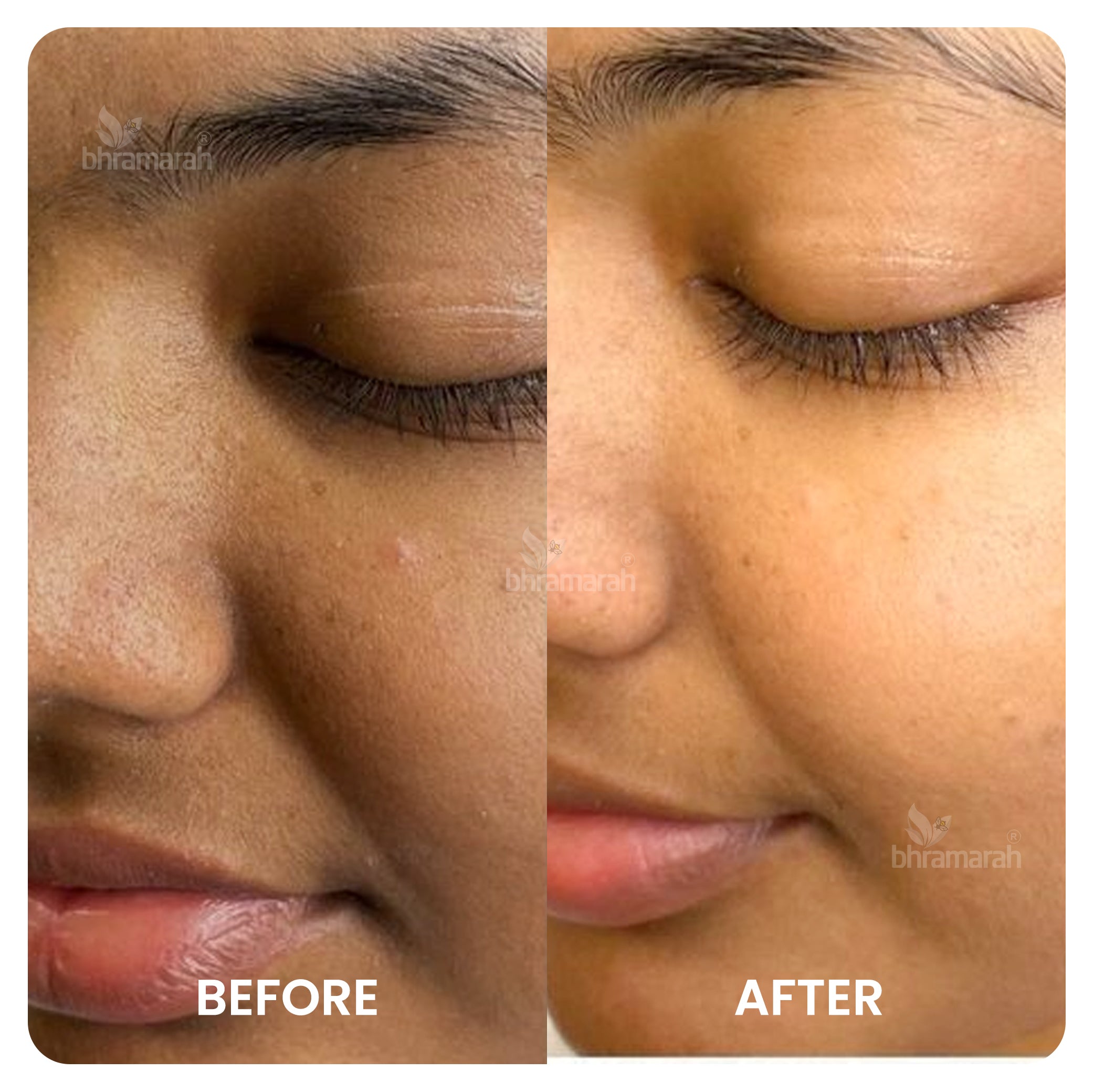 De Tan - Skin Brightening Combo